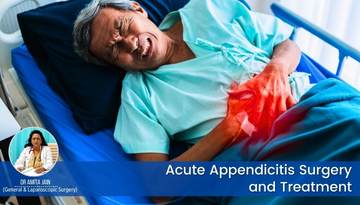 best acute appendicitis surgeon in Delhi